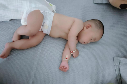 响水宝宝脸上有白色斑块